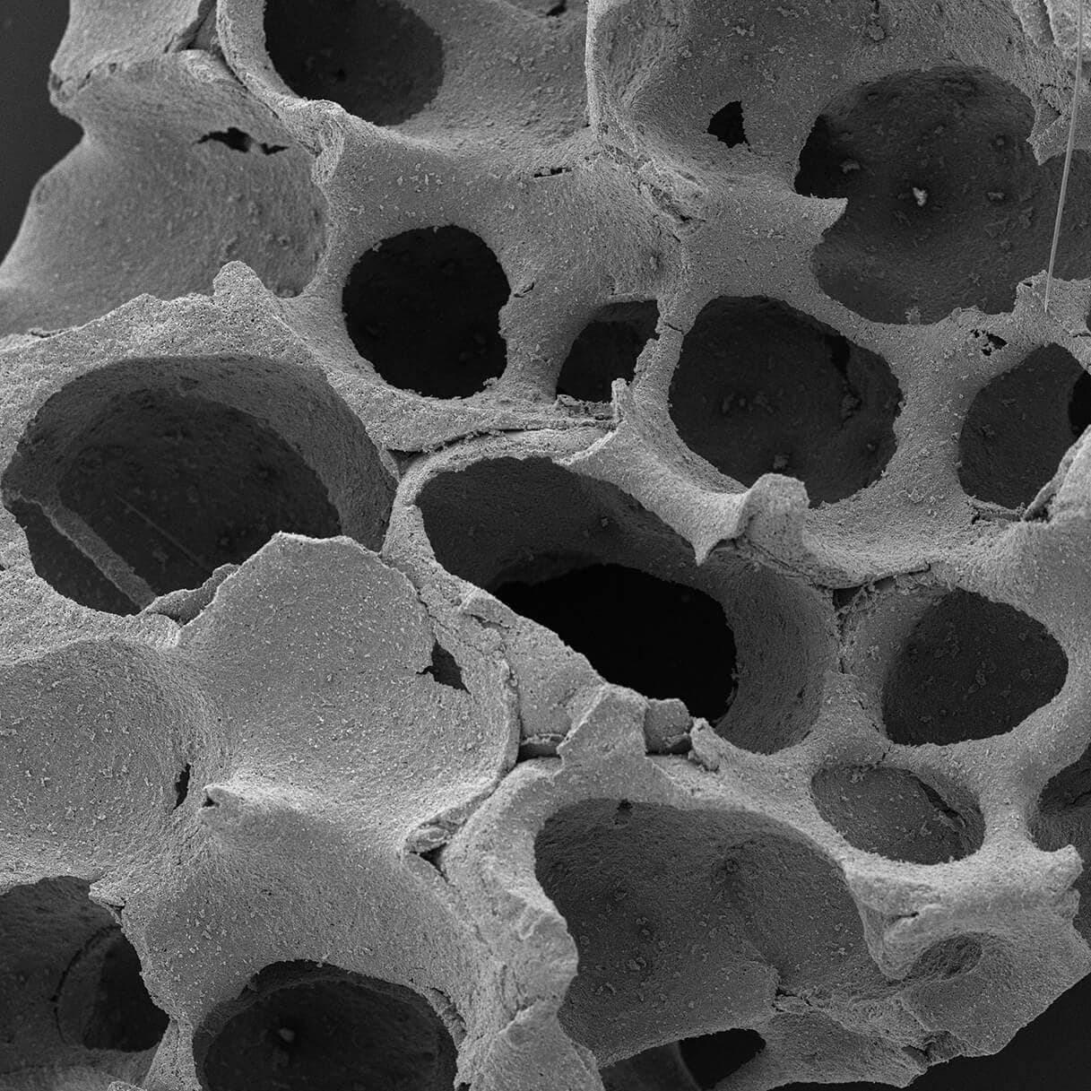 OSBONE aplicación clínica