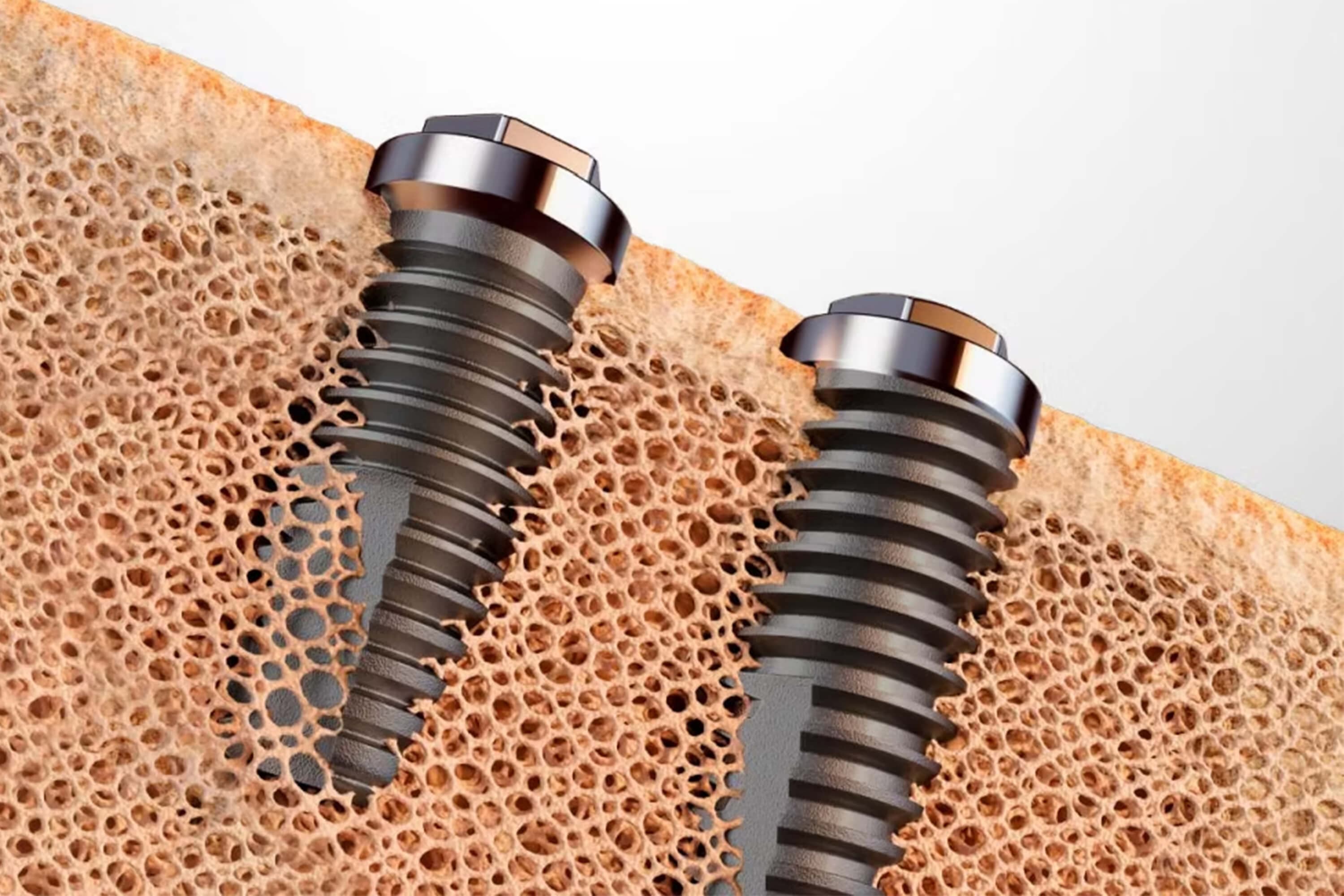 Precisión y Simplicidad S.I.N.