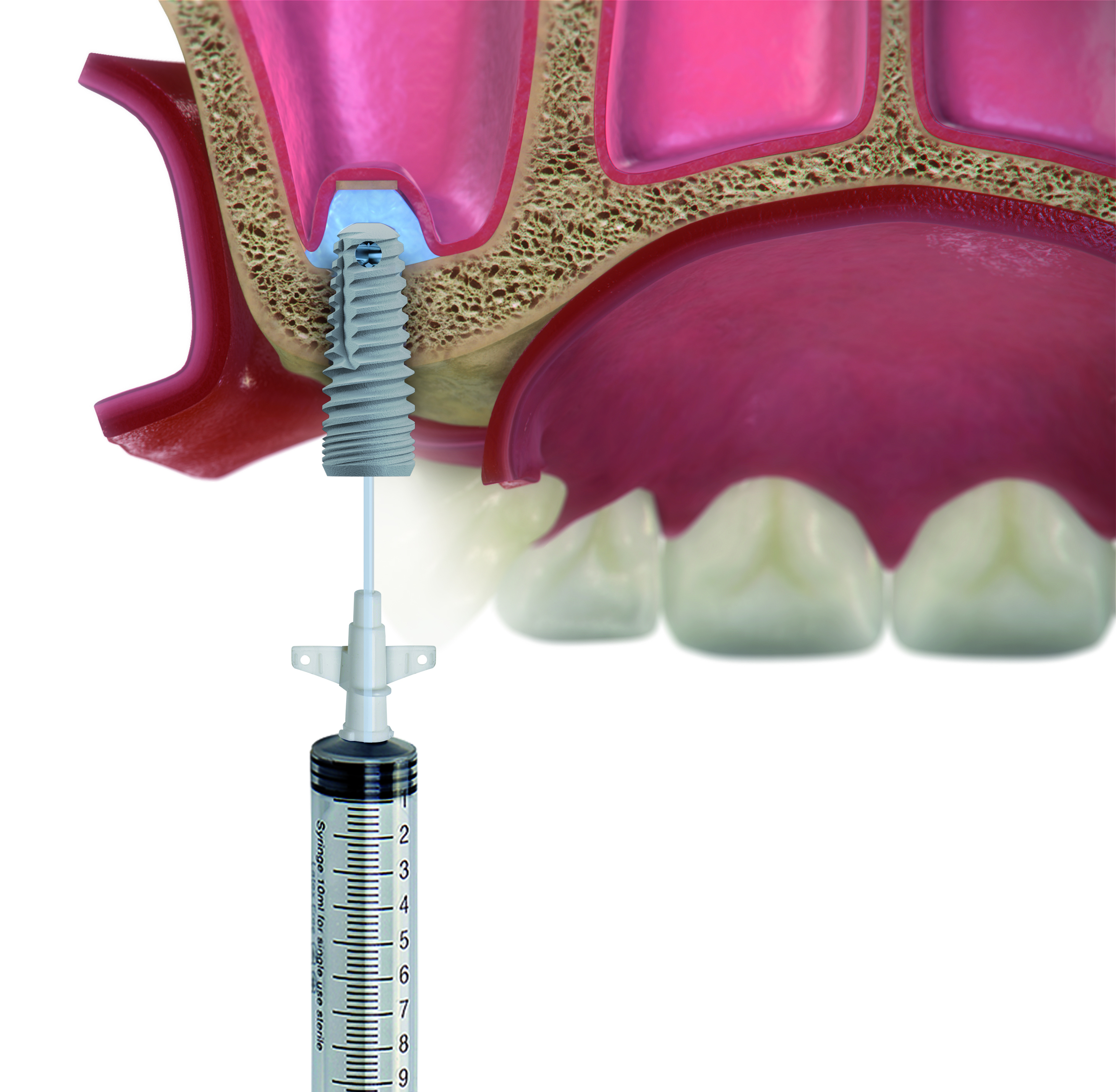 Paso 6 - Sistema DIVA