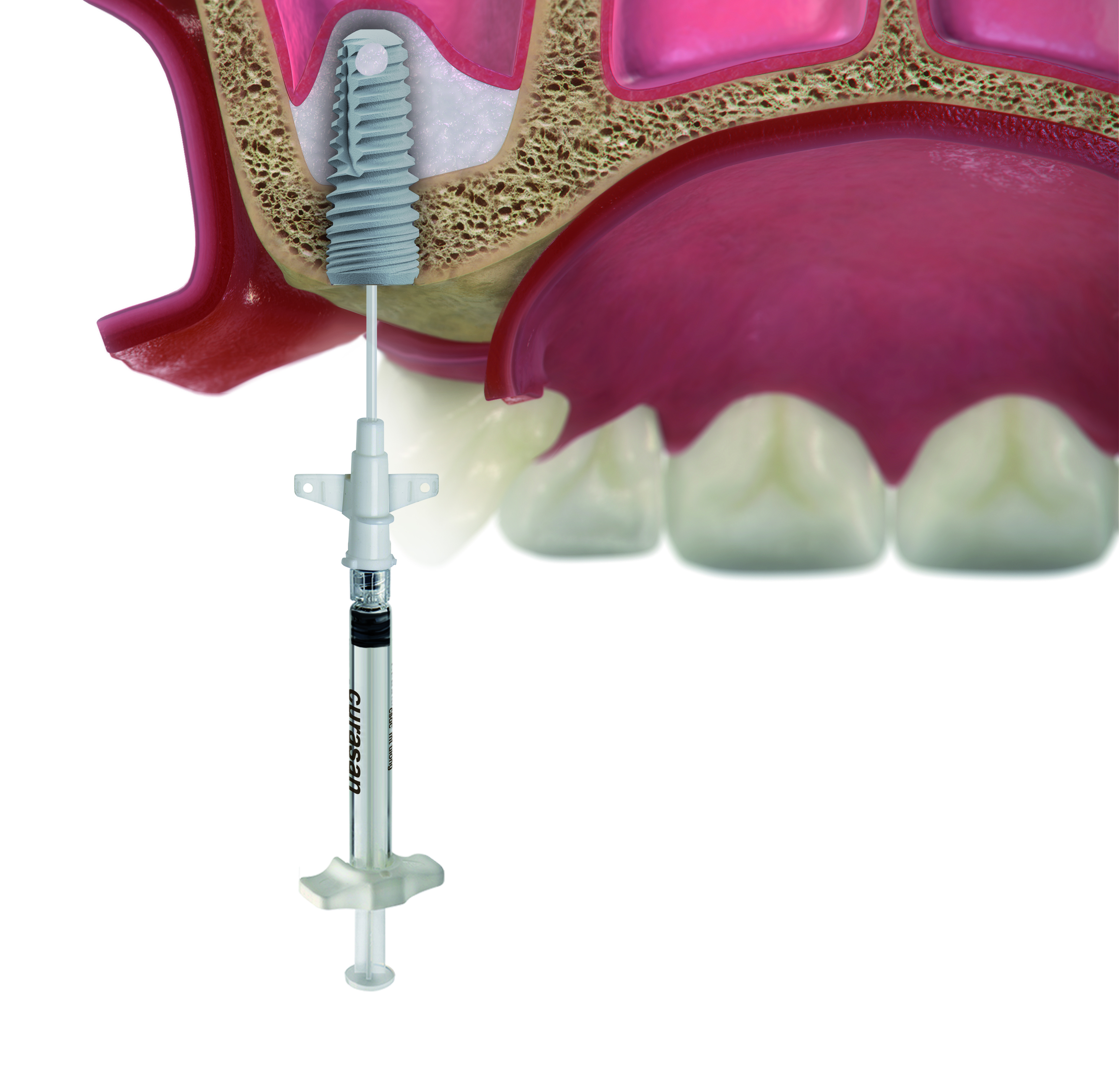 Paso 7 - Sistema DIVA