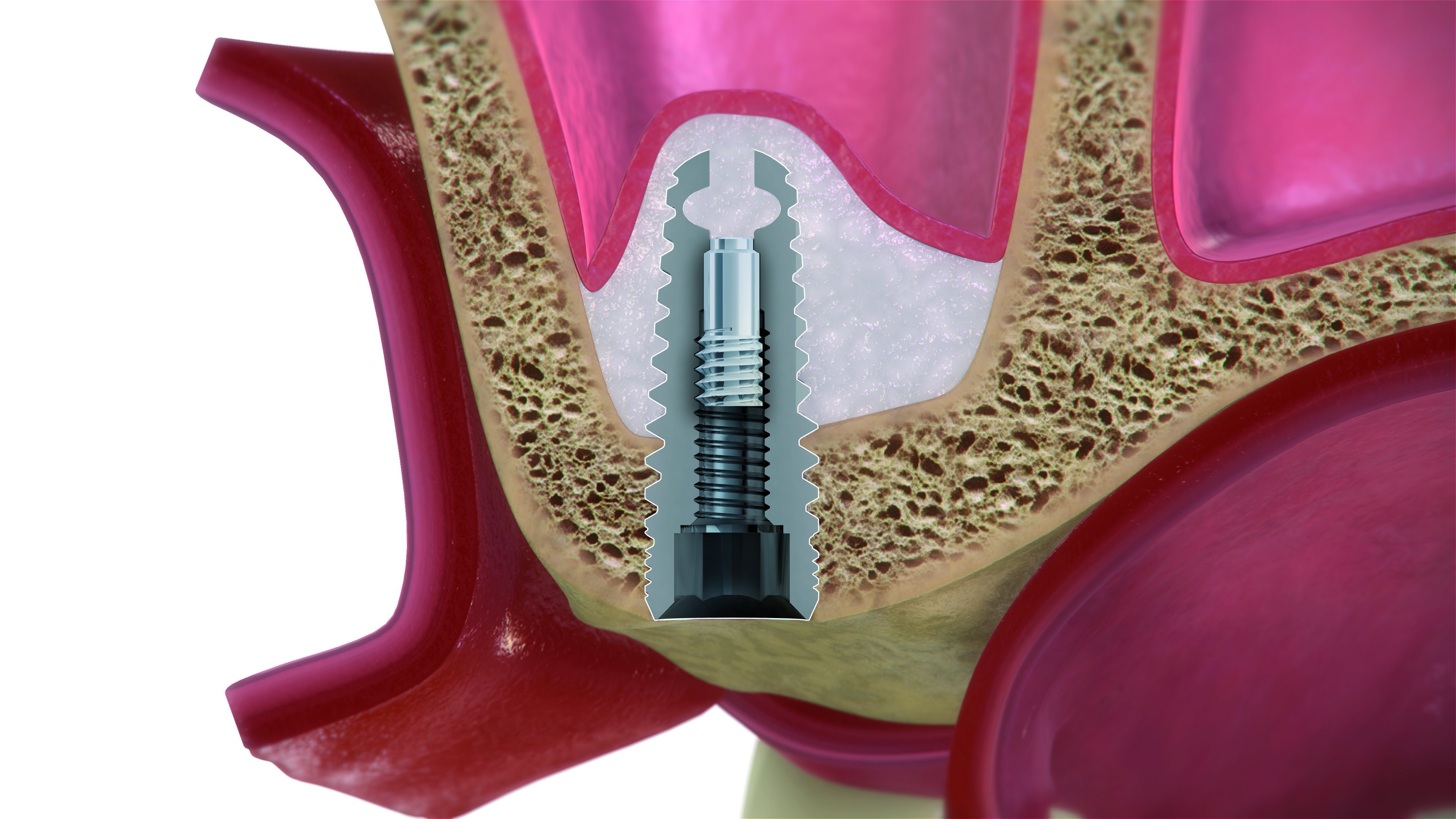 Paso 8 - Sistema DIVA