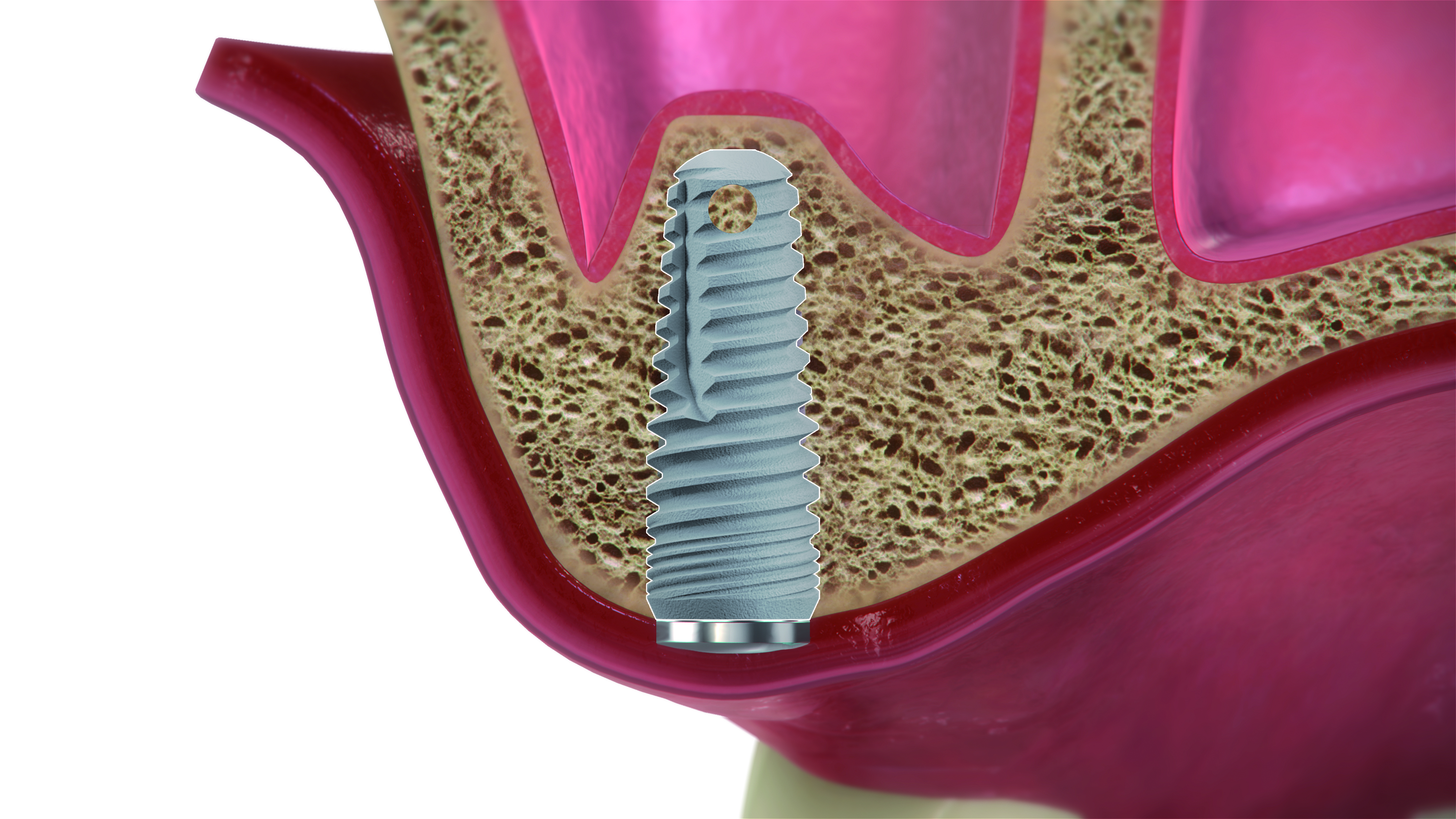 Paso 9 - Sistema DIVA