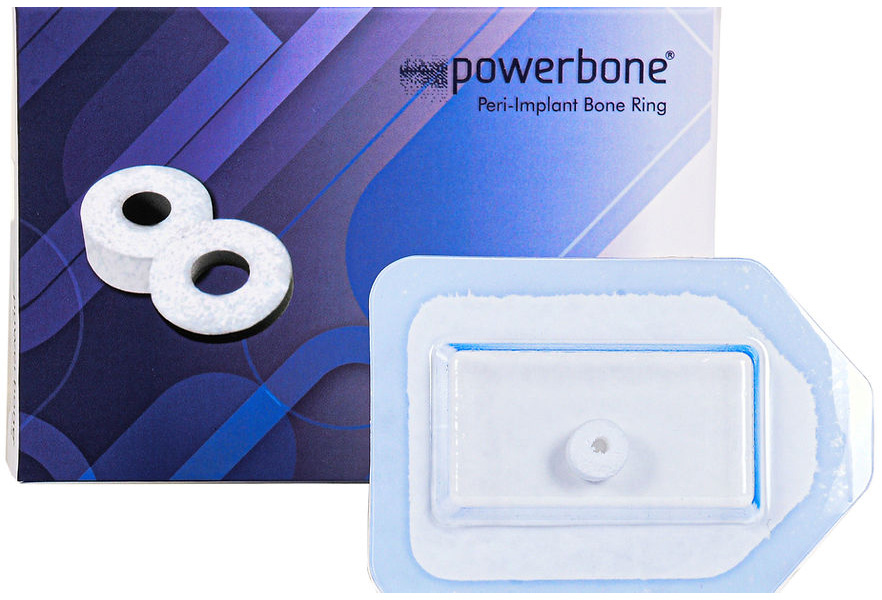 Anillo Periimplantario Powerbone